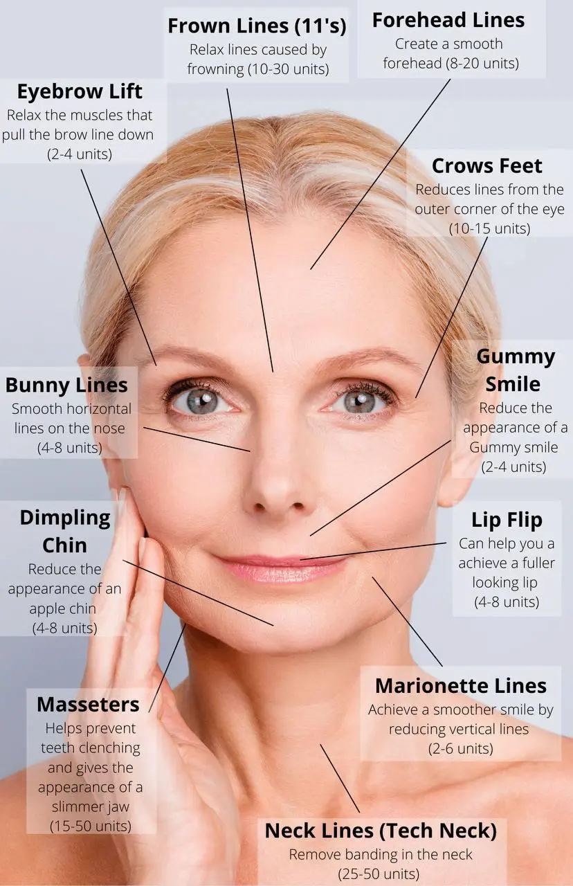 Dynamic Facial Wrinkles